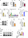 Deficiency of PBX1 drives MC proliferation.
