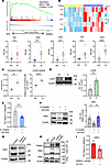 Lactate promotes PBX1 ubiquitination in MCs.