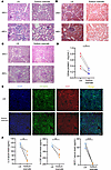 Targeting lactate ameliorates LN in humanized chimeras.