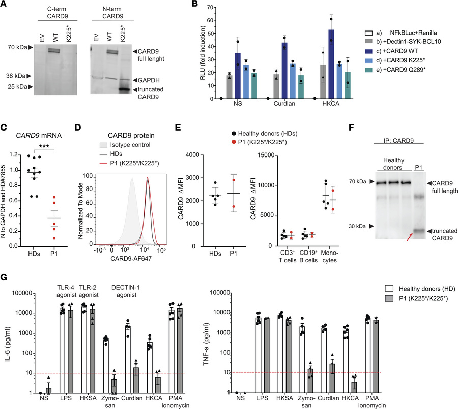 Expression of WT and mutant CARD9 protein in HEK293T cells and patient’s...