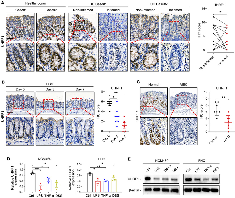 UHRF1 is downregulated in IECs under inflammatory conditions.
(A) Repres...