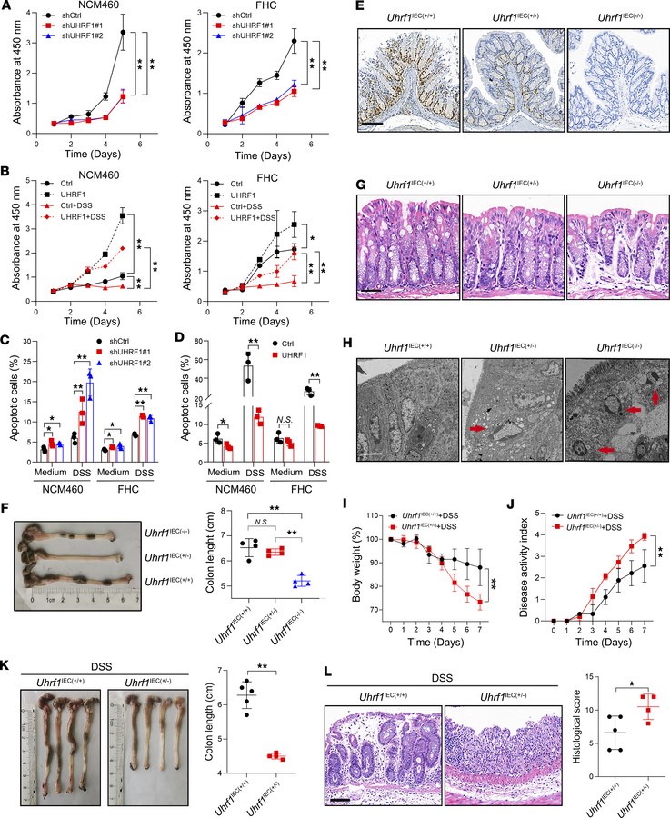 UHRF1 deficiency sensitize IECs to inflammatory damage.
(A) Proliferatio...