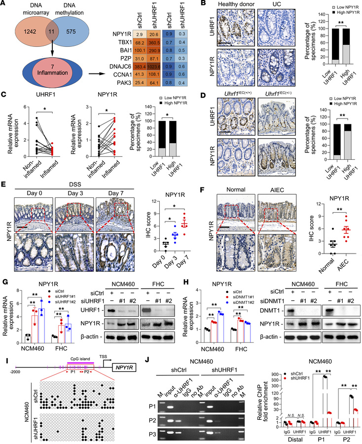 UHRF1 represses NPY1R expression through promoter methylation in IECs.
(...