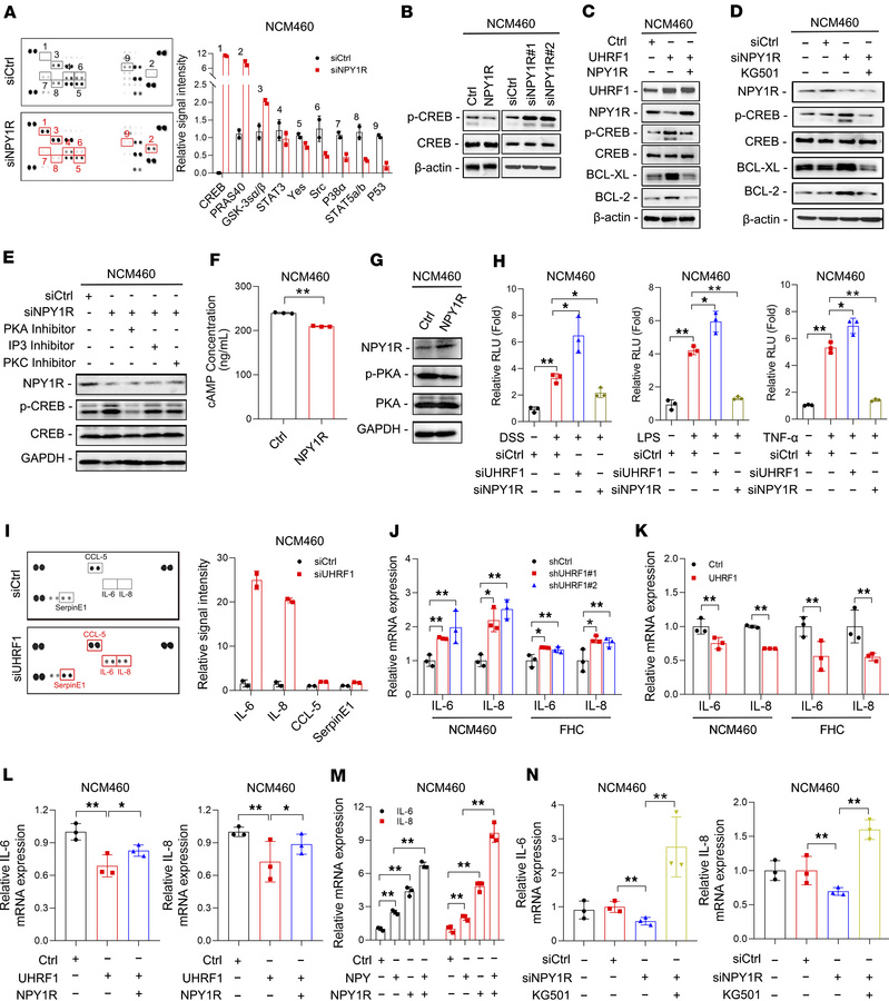 The UHRF1/NPY1R axis protects IECs via CREB activation and NF-κB suppres...