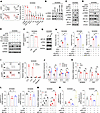 The UHRF1/NPY1R axis protects IECs via CREB activation and NF-κB suppressio