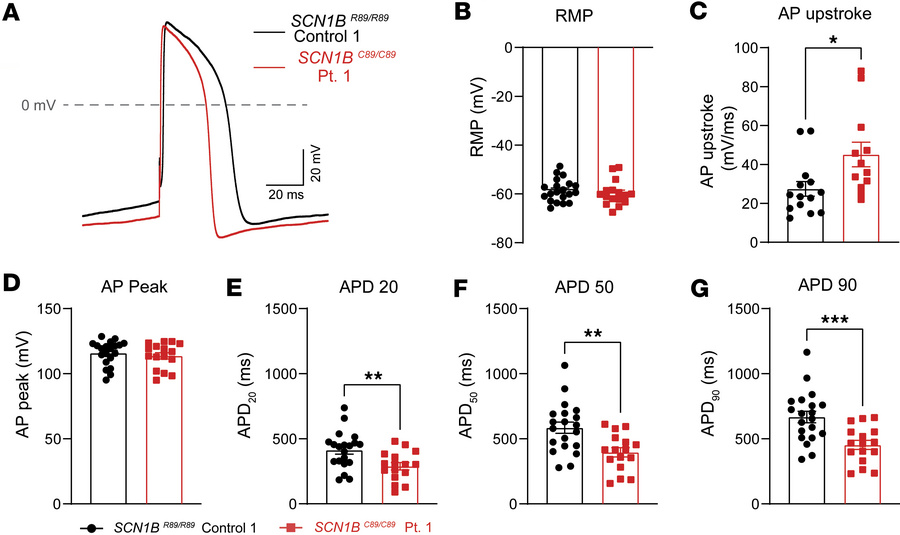 Patient iPSC-CMs show APD shortening.
APs were evoked by pulses of 1.5 t...