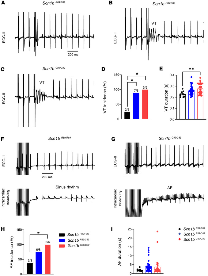 Electrophysiological assessment of cardiac arrhythmias in P18–P25 Scn1bR...