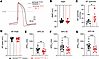 Patient iPSC-CMs show APD shortening.