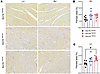 Fibrosis in P18–P25 Scn1bR89/R89, Scn1bR89/C89, and Scn1bC89/C89 mouse hear