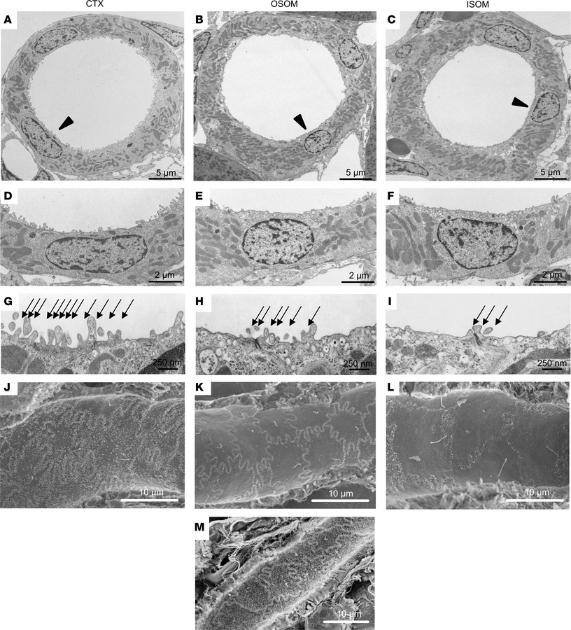 Ultrastructural landmarks in TAL of rat and mouse kidney.
TAL from corte...