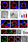 Immunostaining for ROMK, Kir4.1, and CaSR distribution in rat kidney TAL.