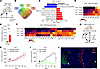 HO inhibition facilitates type I IFN–dependent immunological control of tum
