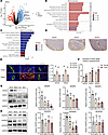 VEGF-related proteins expression in TDLN.