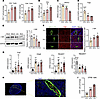 Impaired lymphocyte homing of HEV in TDLN.