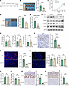 VEGFA was not involved in HEV dedifferentiation and lymphocyte homing.