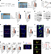 VEGFD induces HEV dilation in TDLN.