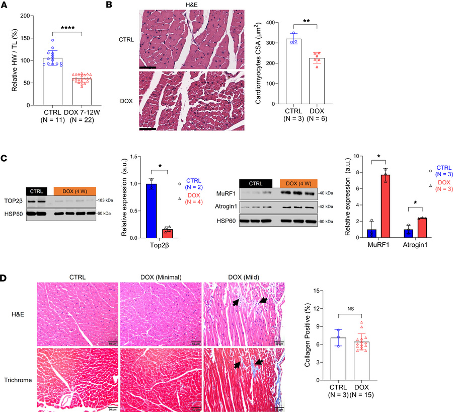 Systemic DOX administration to male mice induces cardiomyocyte atrophy t...