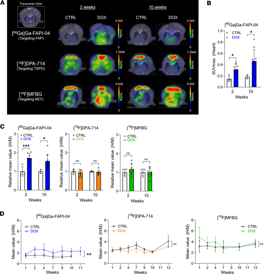 Early-stage FAP expression is detectable with [68Ga]Ga-FAPI-04 PET.
(A) ...