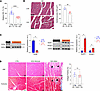 Systemic DOX administration to male mice induces cardiomyocyte atrophy that