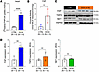 Cardiac [68Ga]Ga-FAPI-04 PET corresponds with tissue levels of FAP expressi