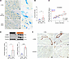 Cardiac [68Ga]Ga-FAPI-04 uptake correlates with FAP expression in cardiomyo