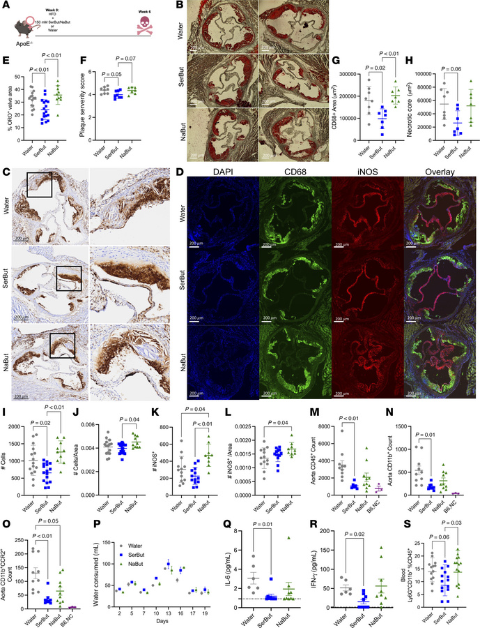 SerBut suppresses the progression of atherosclerotic plaque, accumulatio...