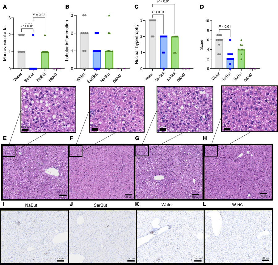 SerBut suppresses liver injury induced by HFD feeding.
Histology of live...