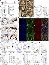 SerBut suppresses the progression of atherosclerotic plaque, accumulation o