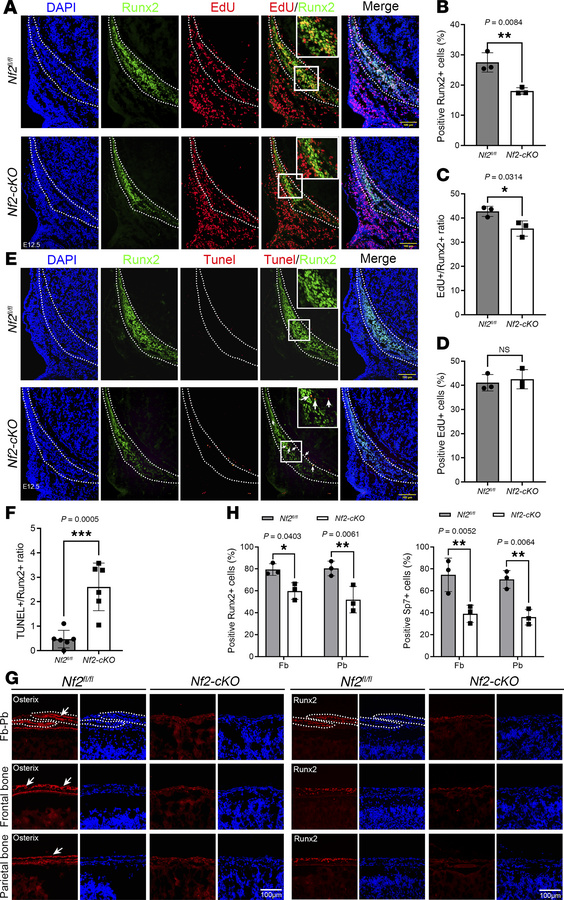 
Nf2 deletion disrupts CNC-derived osteoprogenitor proliferation and dif...