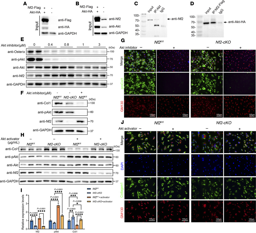 Nf2-Akt interaction governs osteogenic function and collagen production....