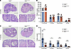 Impaired ovarian function in Helb+/D112Y mutant mice.