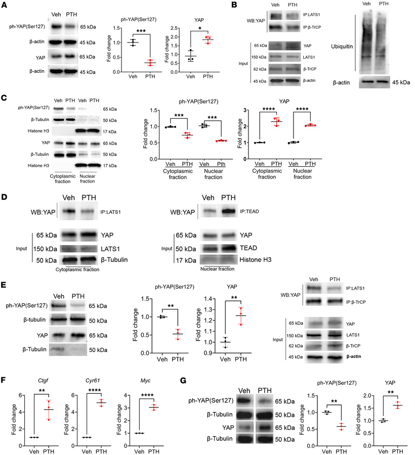 PTH promotes YAP stability in W-20 cells and in OCY454 and OmGFP66.
(A) ...
