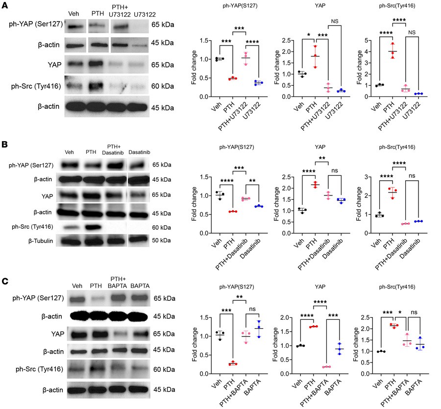 PTH stabilizes YAP via the PLC/Ca2+/Src axis.
(A) Western analysis repre...