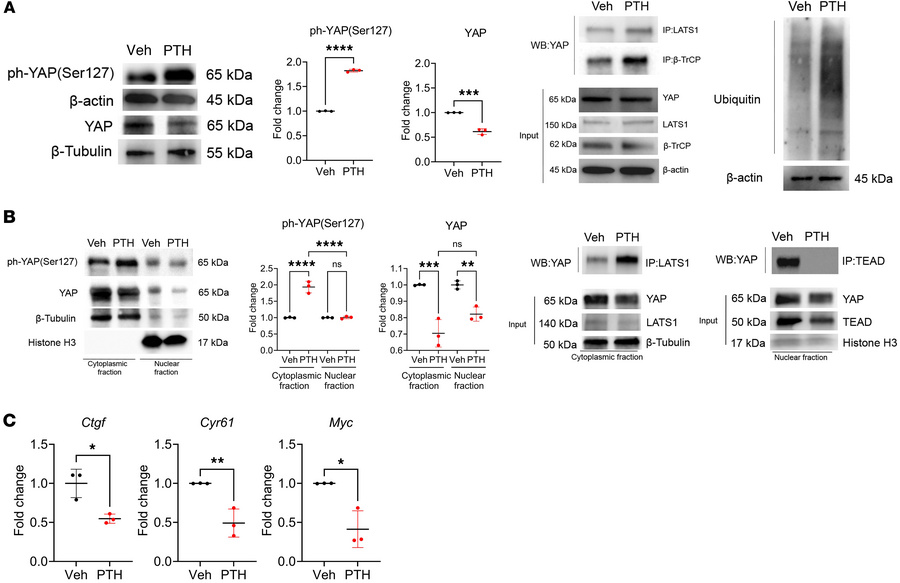YAPY428 phosphorylation is required for PTH-induced YAP stabilization.
(...