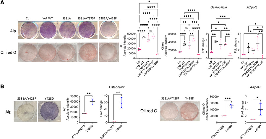 YAPY428 phosphorylation status regulates W-20 differentiation into OB an...