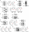 PTH promotes YAP stability in W-20 cells and in OCY454 and OmGFP66.