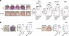YAPY428 phosphorylation status regulates W-20 differentiation into OB and A