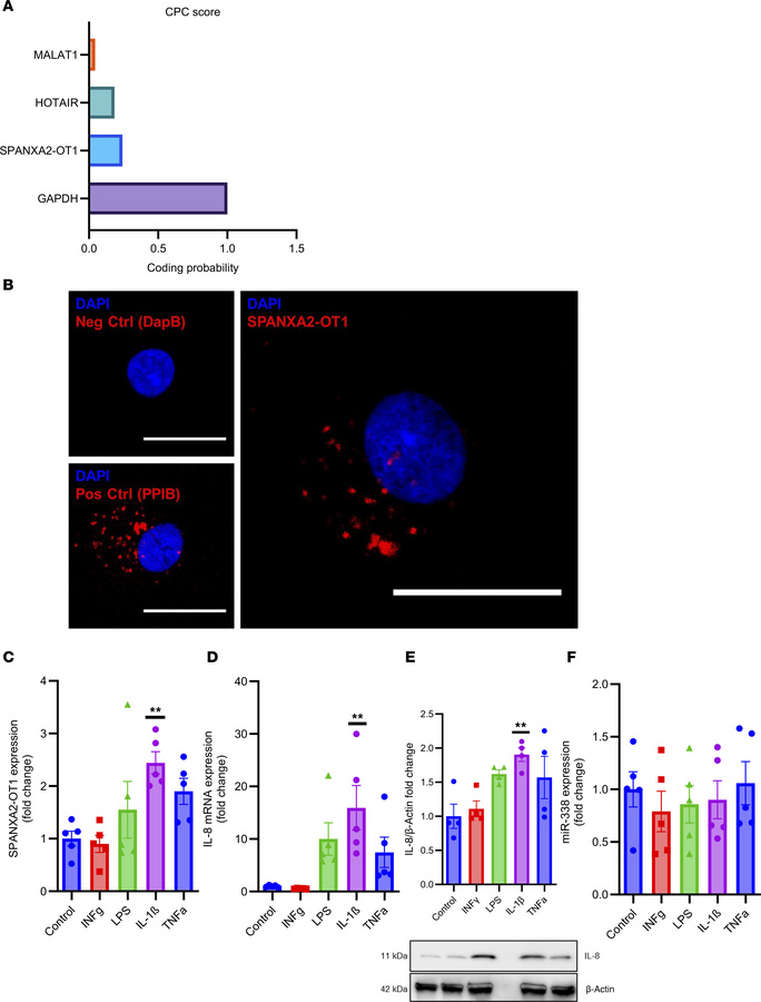 Characterization of lncRNA SPANXA2-OT1 and its target gene in human prim...
