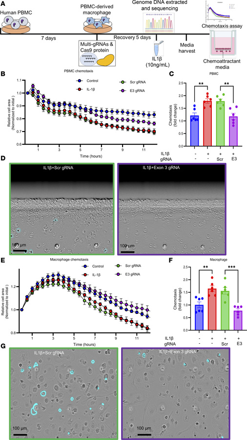 
SPANXA2-OT1 plays a role in macrophage chemotaxis.
Chemotaxis assay of ...