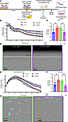 SPANXA2-OT1 plays a role in macrophage chemotaxis.