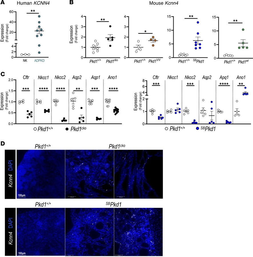 Selective upregulation of KCNN4 in kidneys from human patients with ADPK...