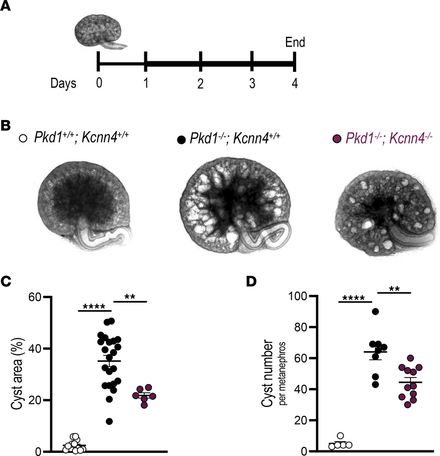 Genetic inactivation of Kcnn4 attenuates cyst development in mouse metan...