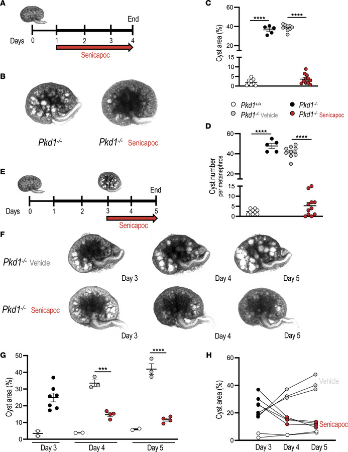 KCa3.1 antagonist senicapoc inhibits ex vivo cyst growth and promotes re...