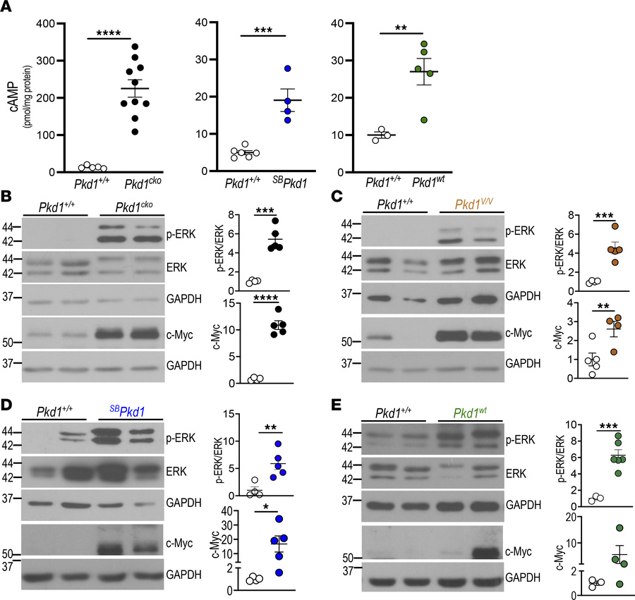 Signaling effectors associated with cyst enlargement in kidneys of 4 Pkd...