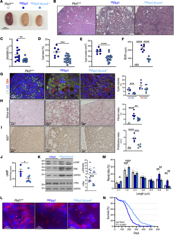 
Kcnn4 inactivation in SBPkd1 mice attenuates cellular and molecular ind...