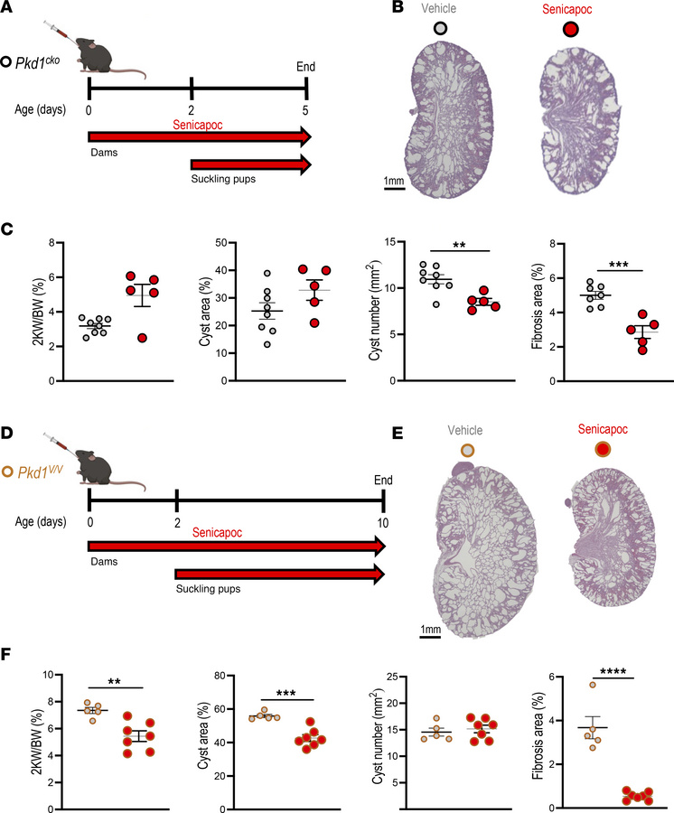 KCa3.1 inhibitor senicapoc reduces cyst growth in 2 early-onset Pkd1 mou...