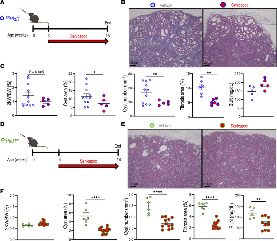 KCa3.1 inhibitor senicapoc reduces cyst growth in 2 late-onset Pkd1 mous...