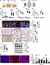 Kcnn4 genetic inactivation attenuates PKD pathology in Pkd1cko mice.