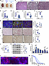 Kcnn4 inactivation in SBPkd1 mice attenuates cellular and molecular indices
