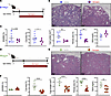 KCa3.1 inhibitor senicapoc reduces cyst growth in 2 late-onset Pkd1 mouse m